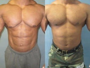 Oxandrolona e stanozolol antes e depois